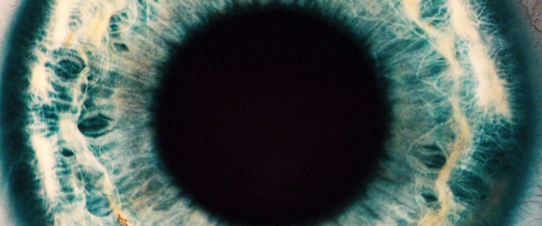 Arboria - Eye